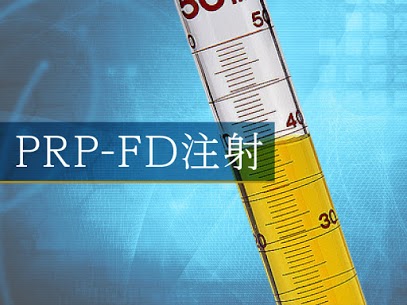 prp-fd注射