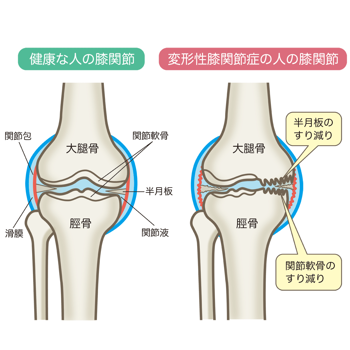 膝のしくみ ひざ痛クリニック情報 ひざ治療ブログ 銀座の整形外科病院