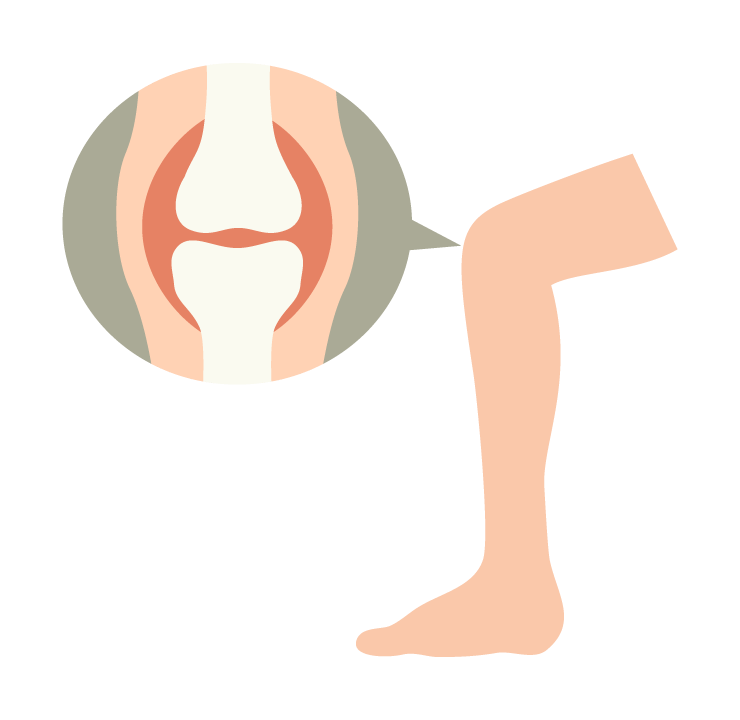 膝関節 レントゲン ひざ痛クリニック情報 ひざ治療ブログ 銀座の整形外科病院